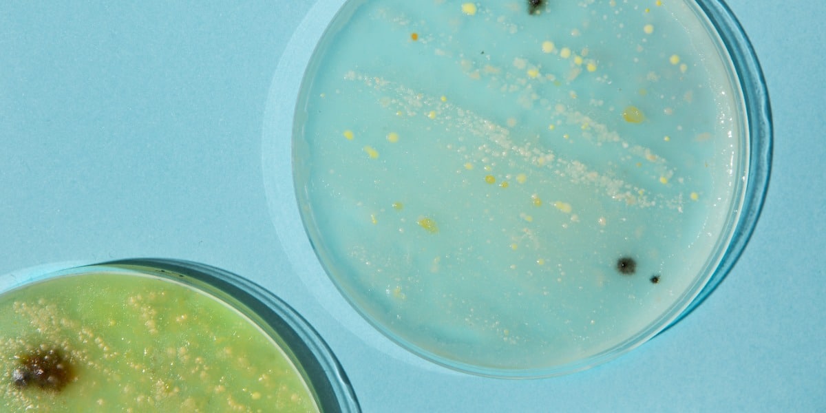 Choosing a Competent E.coli Strain