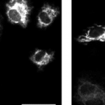 Imaging The World's Brightest Luminescent Protein With Photometrics Evolve