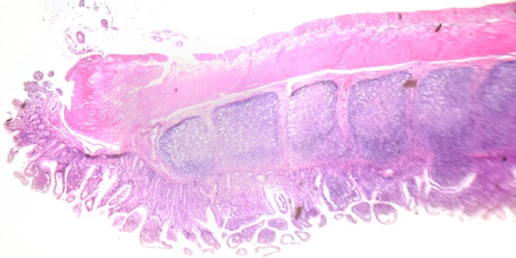 histology image of large intestine to depict tissue processing for histology