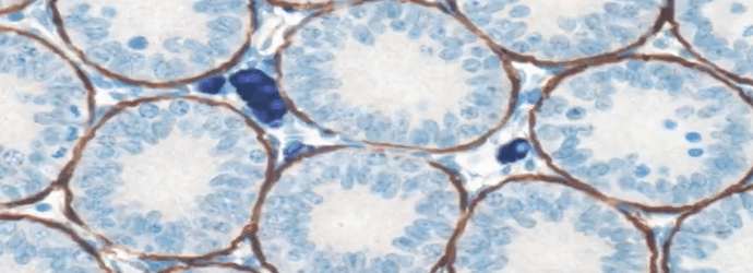 basic_methods_for_immunohistochemistry