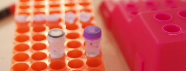 Should PCR cloning be a part of your molecular cloning toolkit?