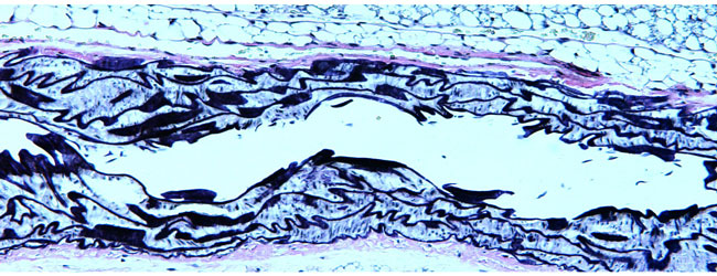 elastic fibers diagram