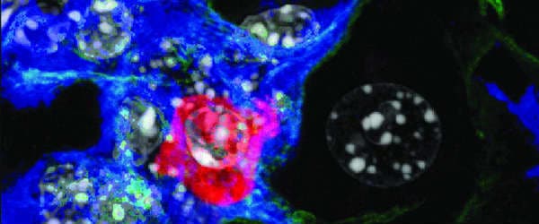 Intracellular Cytokine Staining: Letting It All Build Up Inside