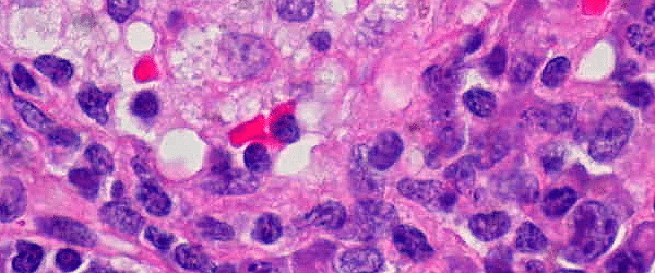 Digital Pathology – why you need it and how to choose the best camera for it