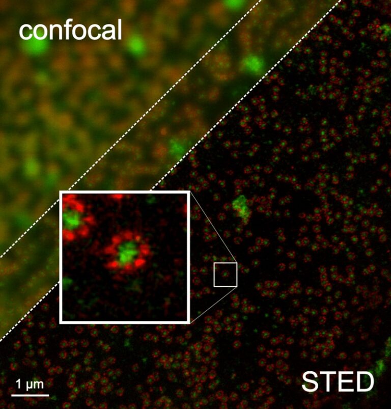 Microscopy image showing fluorescent details.
