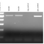 Homemade PCR Test for Mycoplasma Contamination