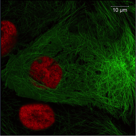 Choosing a Fluorescent Protein: 6 Critical Considerations