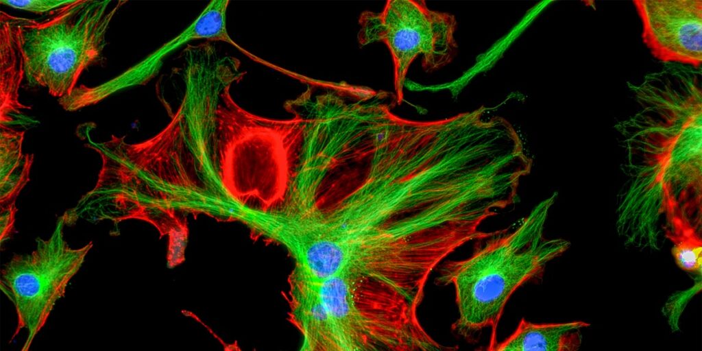 confocal microscopy