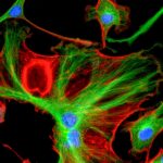 multicoloured cells imaged on a confocal microscope to illustrate how you can improve your confocal images