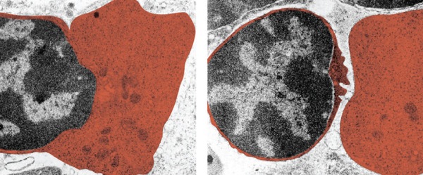 How to Take a Publication-Worthy Electron Micrograph