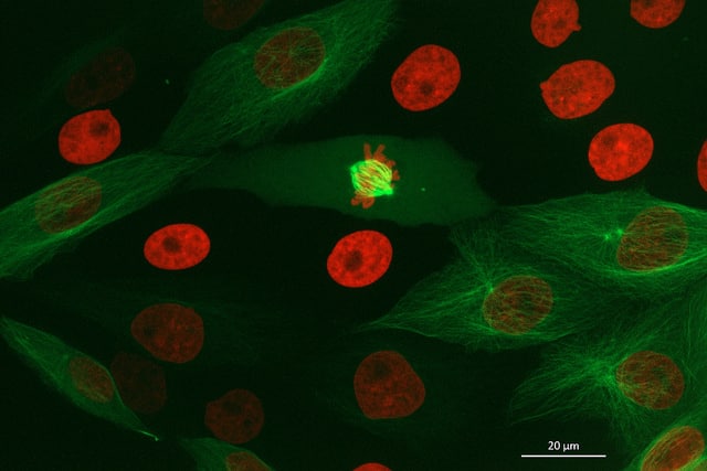 How to See the Cell Cycle Through Your Microscope