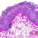 Image of Haematoxylin and Eosin Staining