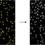 Quick and Easy Automatic Cell Counting