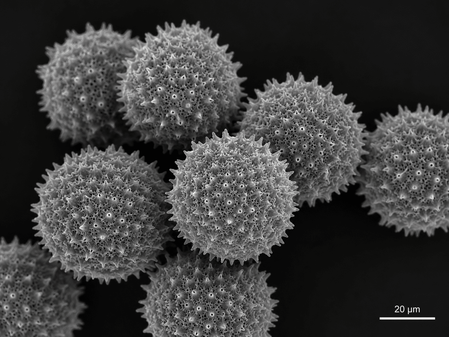 Three-Dimensional Scanning Electron Microscopy for Biology