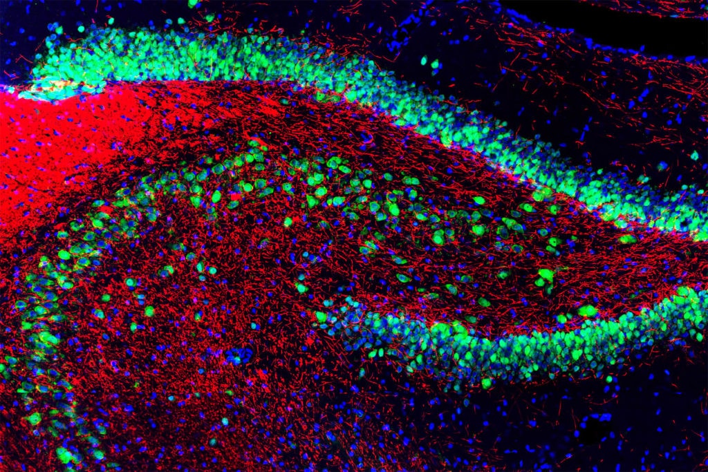 Extracting Better Ubiquitin Data from Your Samples: Beyond the Cellular Skip