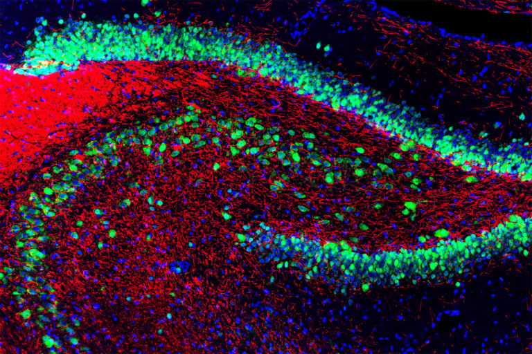 Extracting Better Ubiquitin Data from Your Samples: Beyond the Cellular Skip