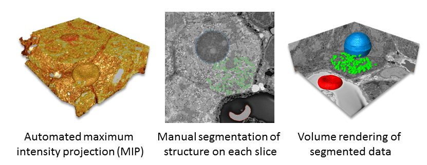 Data Analysis for Three-dimensional Volume Scanning Electron Microscopy