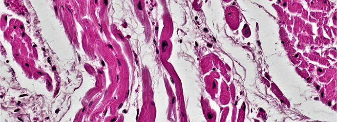 Cardiac Muscle