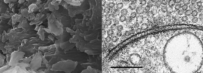 Electron microscopy image