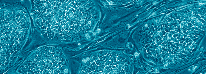 Human_embryonic_stem_cells_only_A
