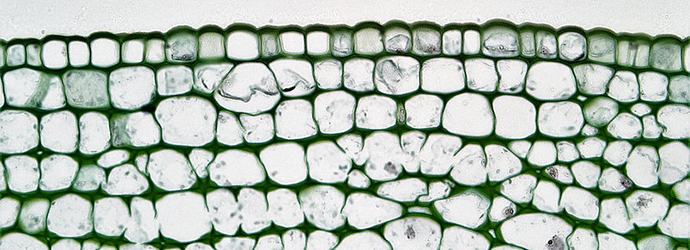 Herbaceous Dicot Stem: Cortex Collenchyma in Older Richinus