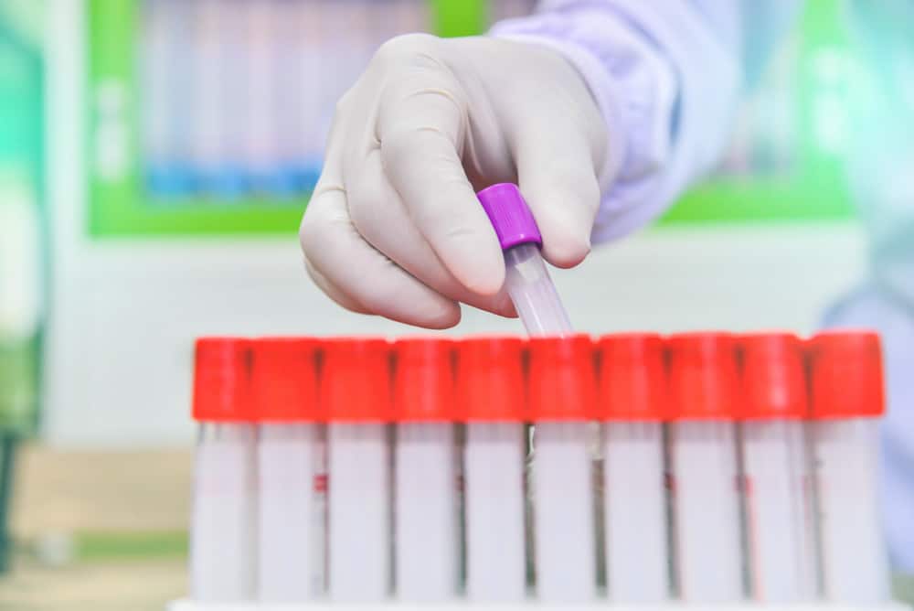 An image of test tubes to depicts how to clean a water bath.