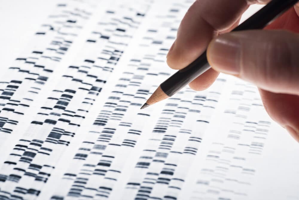 The lac Operon as a Microscopy Tool