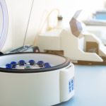 Benchtop centrifuge on lab bench with open lid to highlight important considerations for centrifugation.