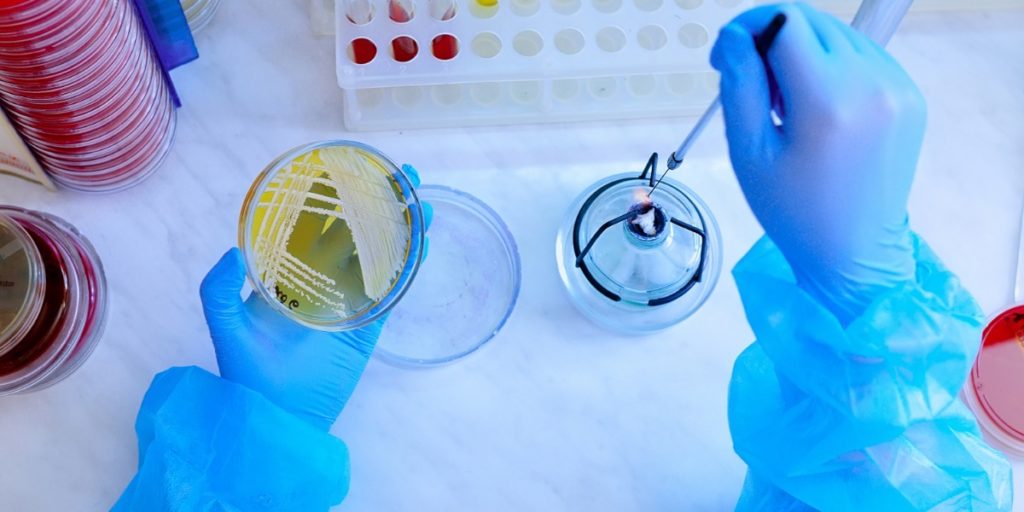 Petri dishes showing bacterial growth with bunsen burner denoting sterile technique