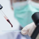 Scientist holding a blood smear slide with microscope in the foreground