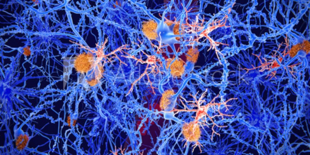 image of microglia