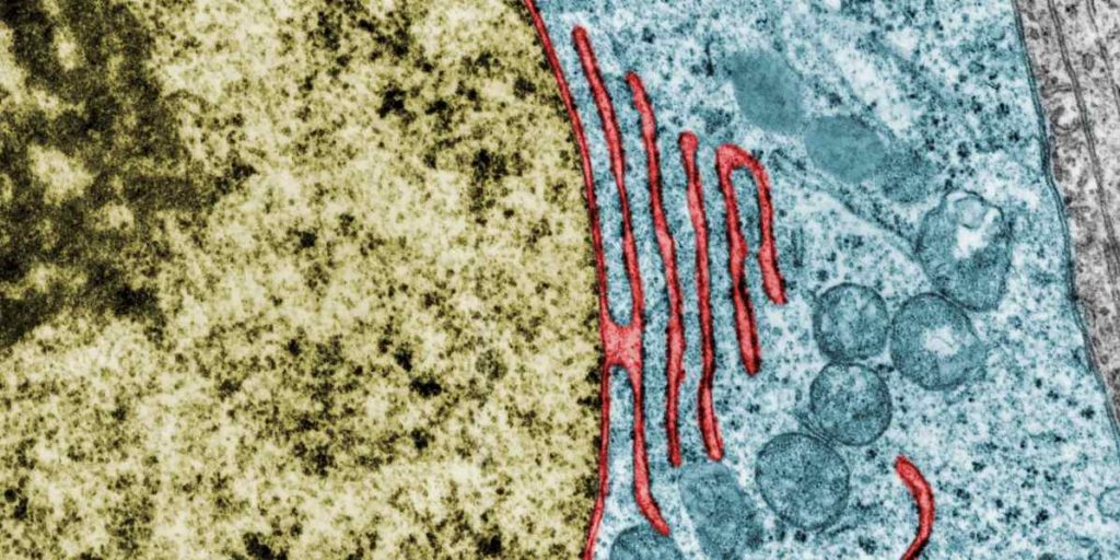 Transmission electron microscopy of the nuclear envelope