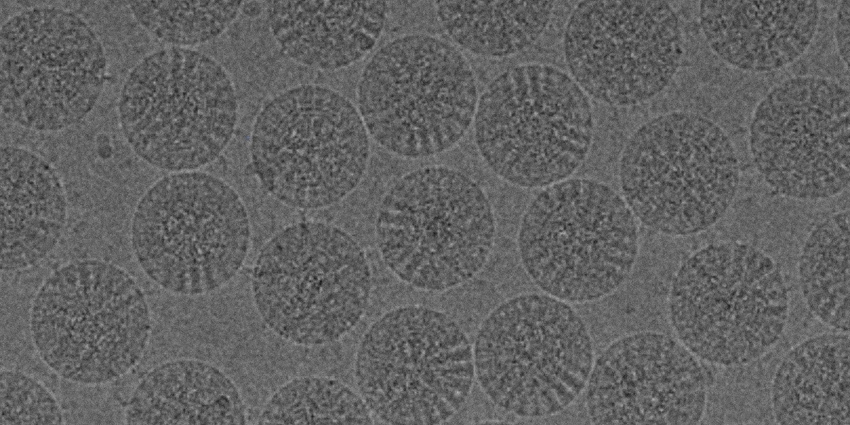 Electron microscopy image of virus particles demonstrating the usefulness of electron microscopy of viruses and virology