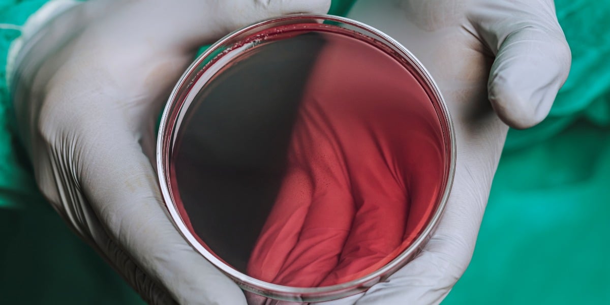 https://bitesizebio.com/wp-content/uploads/2021/02/doctor-showing-blood-agar-plate-1.jpg