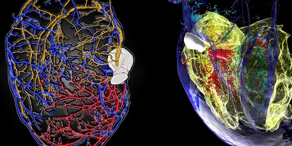 Mesoscopic Whole Organ Imaging - Of Experimental Models and Diagnostic Potential