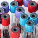 Choosing The Right Blood Collection Tubes