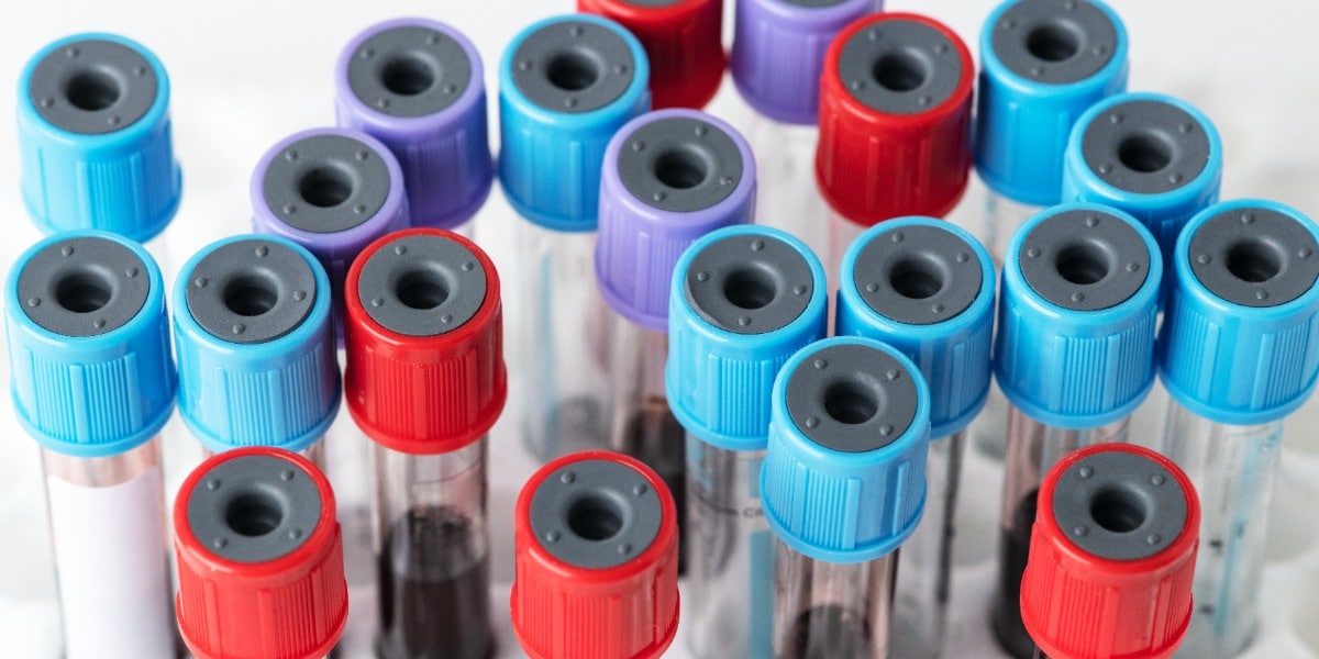 Choosing The Right Blood Collection Tubes