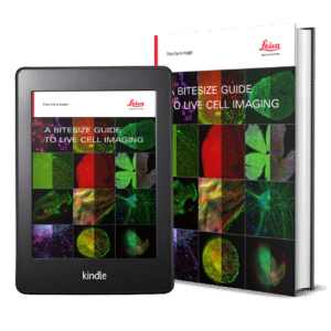 Your guide to successful imaging of living cells