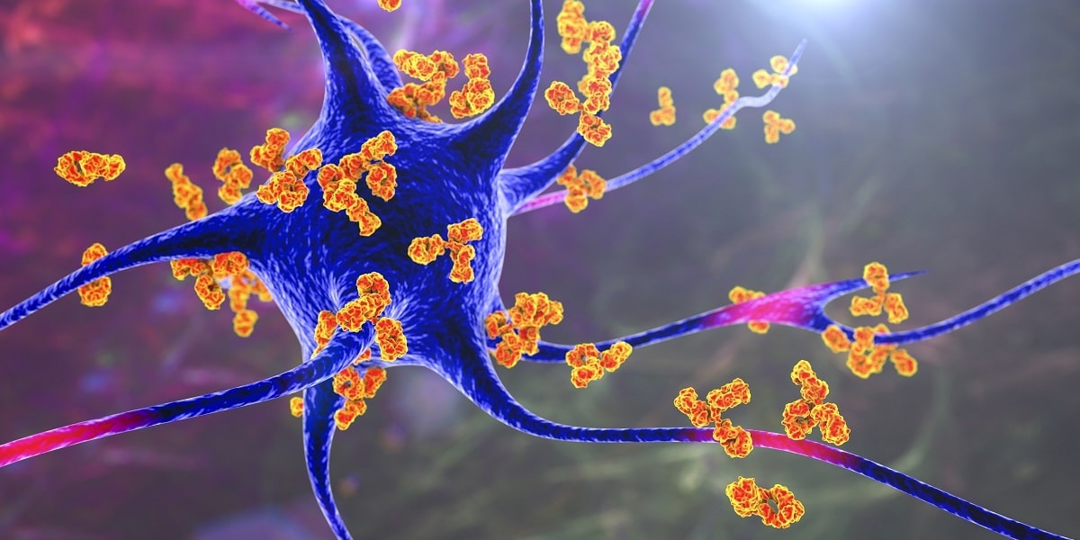 An image of antibodies attacking a neuron to depict the application of immunosequencing in autoimmune disease research