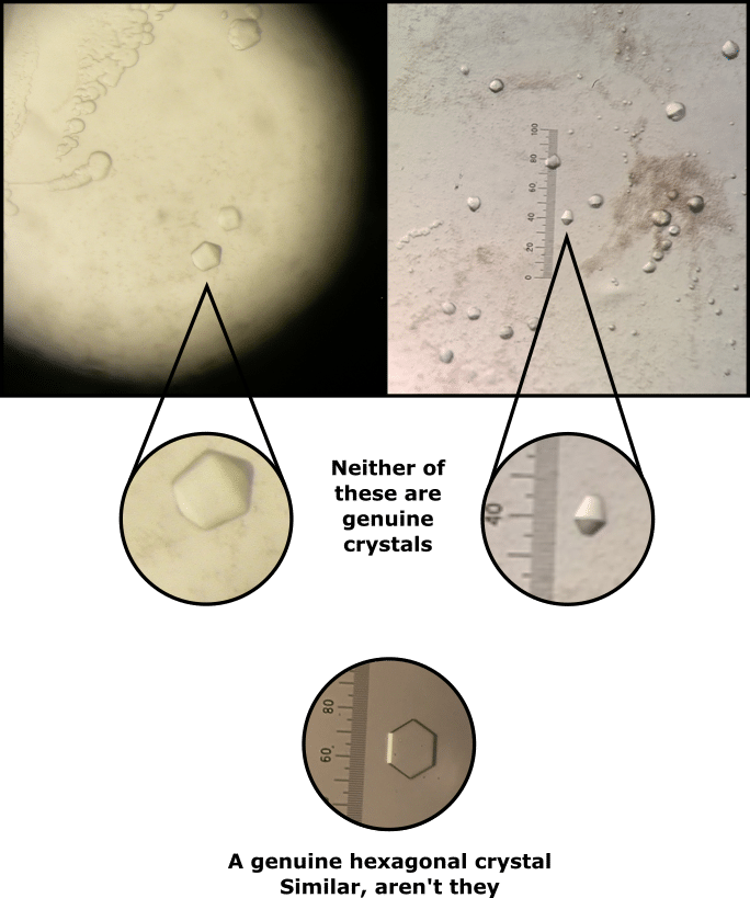 6 Easy Ways to Remove Excess Detergent from Membrane Proteins