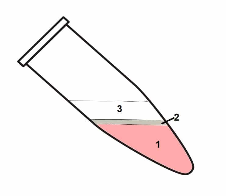 Total RNA extraction using TRIzol.