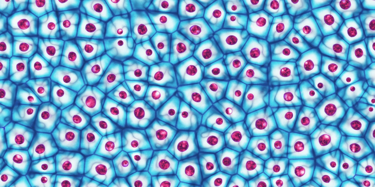 Cells under a microscope to explain what cell confluency is