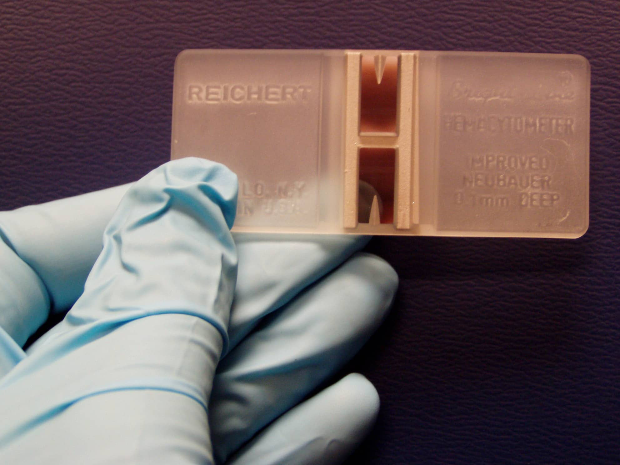 Cell Counting With a Hemocytometer As Easy as 1, 2, 3