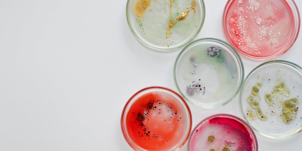 bacterial colonies on agar plates to depict how to Better Preserve Microorganisms.