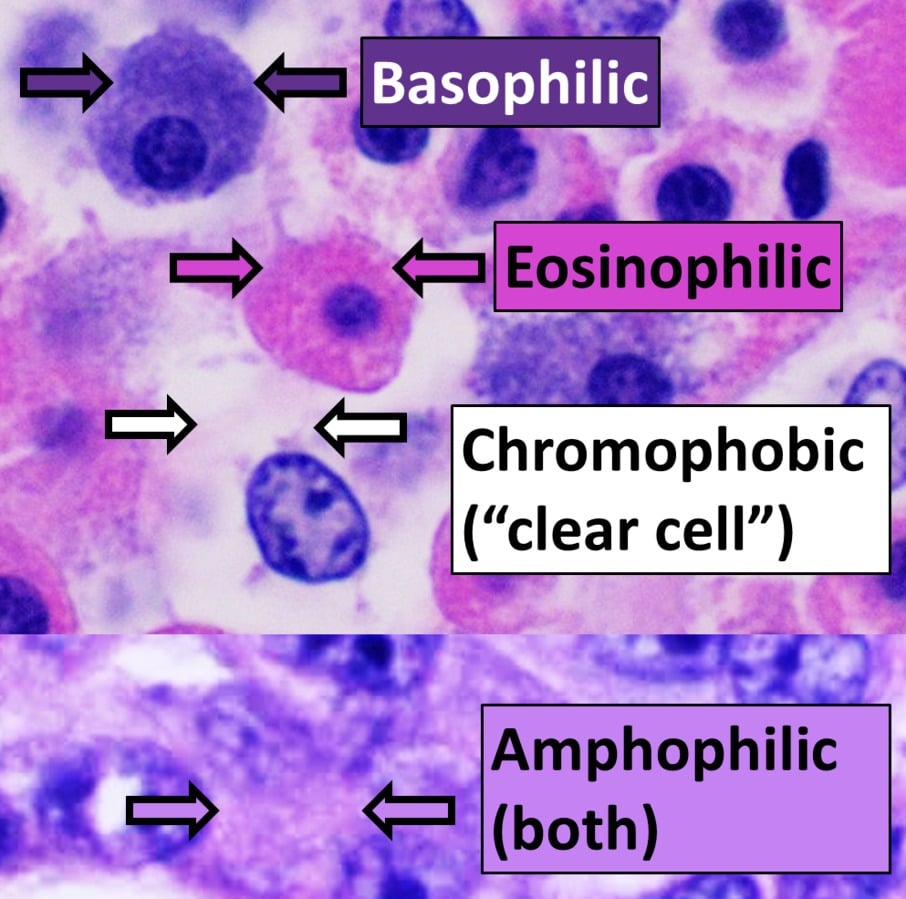 Hematoxylin And Eosin Staining A Really Easy Introduction 0078