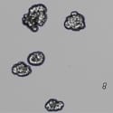 Learn to Automate Organoid Counting with the CellDrop Automated Cell Counter