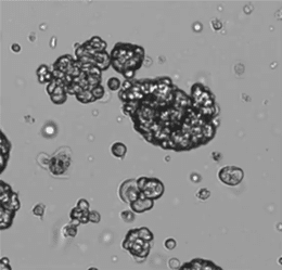 How to Count Organoids Accurately: Smarter Quantification for 3D Cell Models