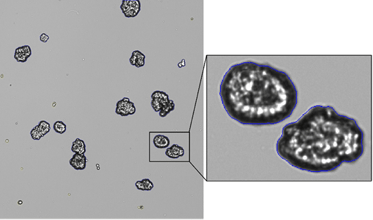 How to Count Organoids Accurately: Smarter Quantification for 3D Cell Models