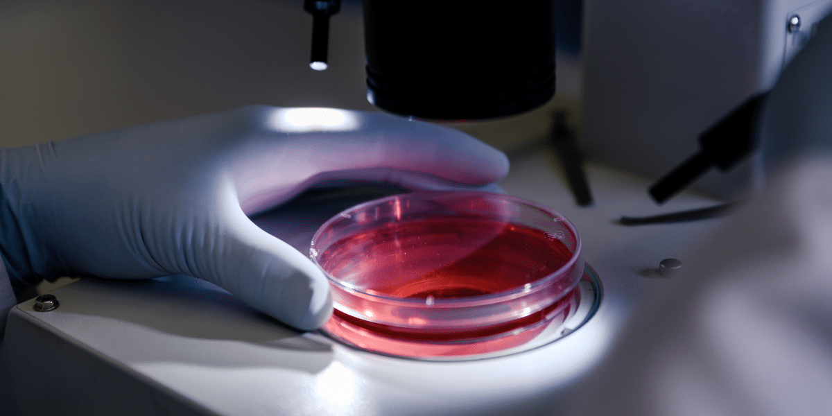 Image of a cell culture dish to represent how to calculate cell proliferation rate