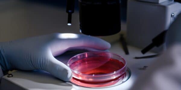 Image of a cell culture dish to represent how to calculate cell proliferation rate